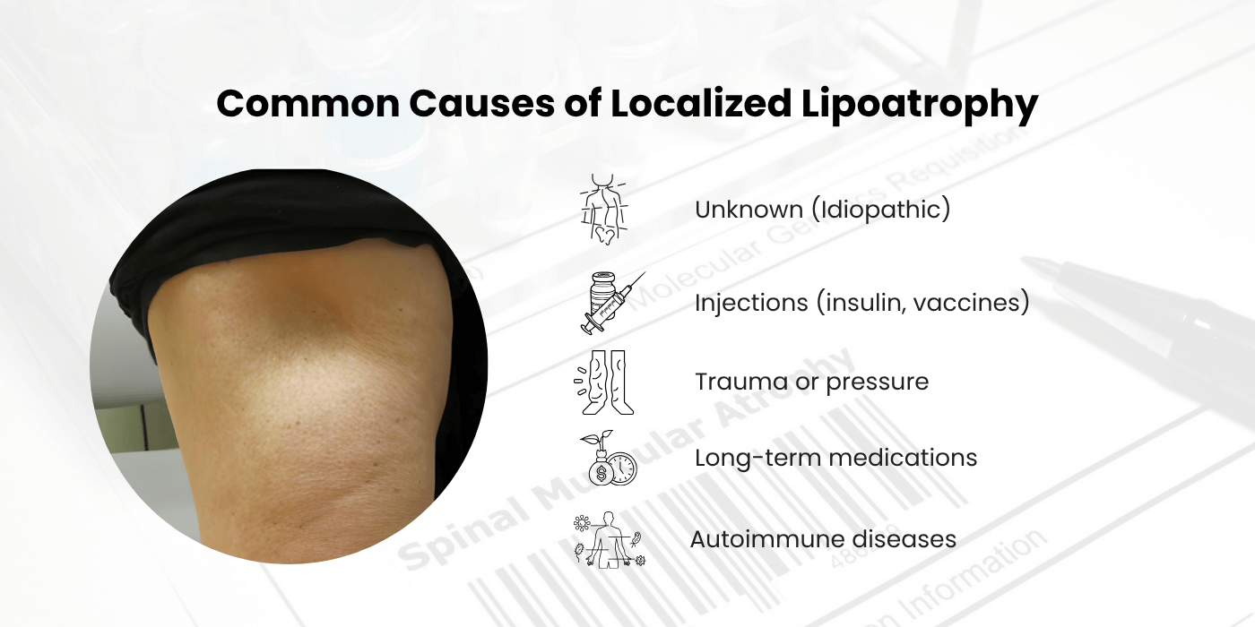 Common Cause of Localized Lipoatrophy