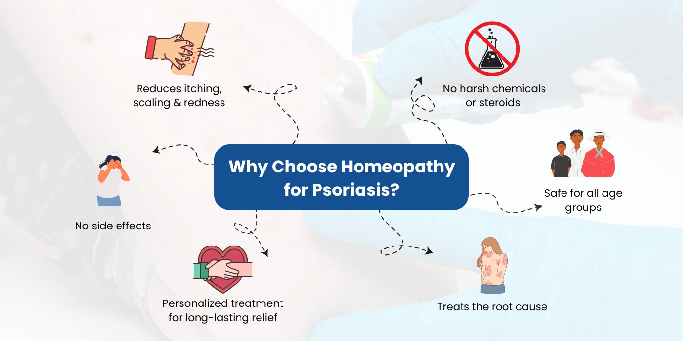 Homeopathic Treatment for Psoriasis
