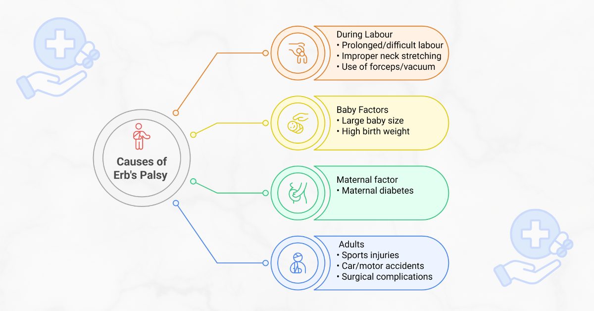 Causes of Erb’s Palsy